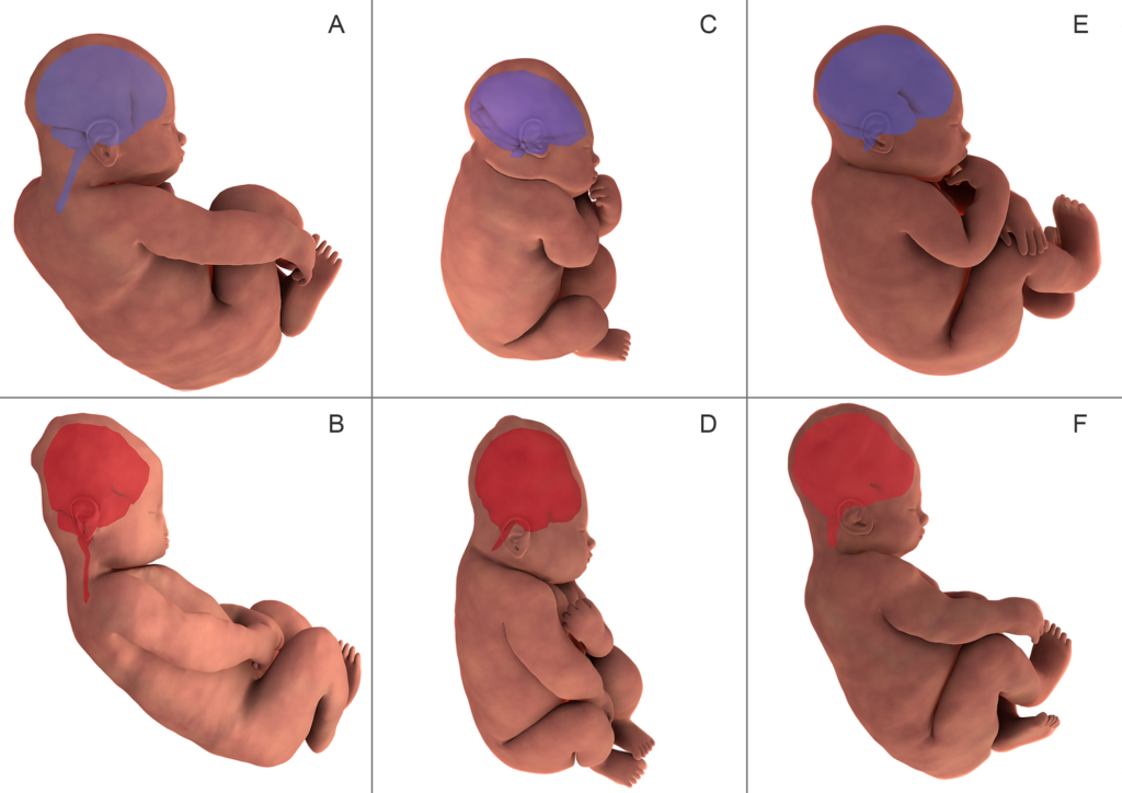 studio sulla forma del cranio del neonato