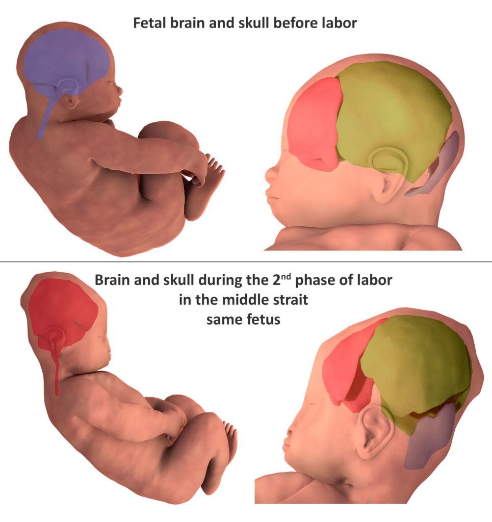 forma del cranio e del cervello del neonato